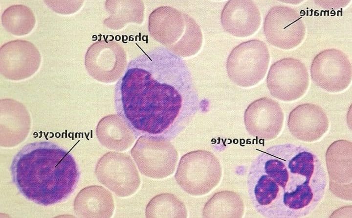 Leucocytes élevés : quelles sont les causes et comment y remédier ?