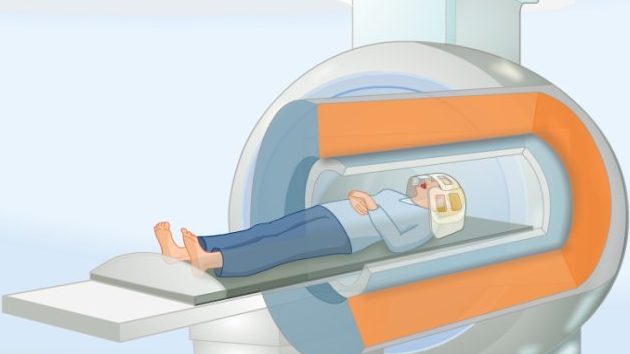 Tout savoir sur l&rsquo;IRM du genou : procédure, préparation et résultats