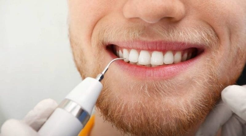 Que faire en cas de dent cassée en attendant le dentiste ?
