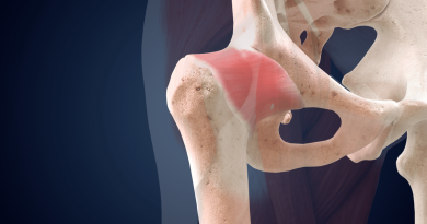 Les secrets de l&rsquo;anatomie du genou : Comprendre pour mieux prévenir les blessures